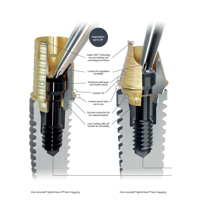 Elos Hybrid Base Diagram