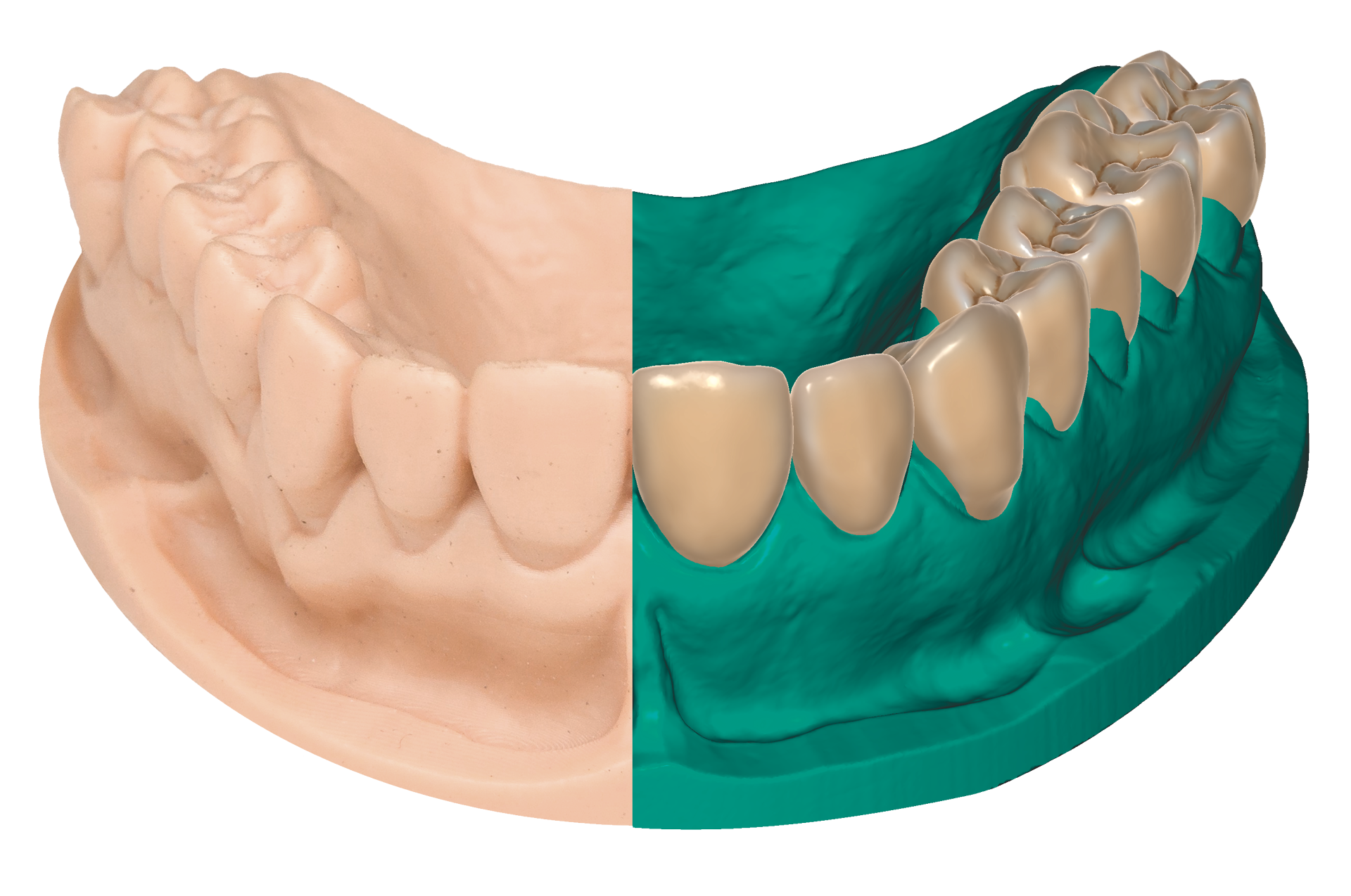 exocad Smile Creator